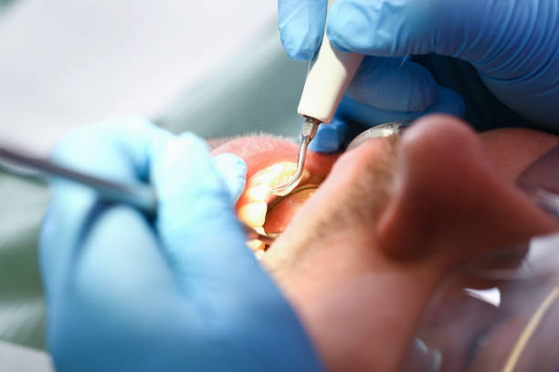 Best Emergency Denture Repair in Kenwood Estates, FL