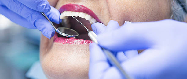 Best Emergency Root Canal Treatment in Kenwood Estates, FL